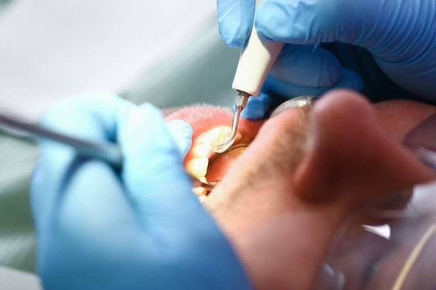 Best Broken Tooth Emergency  in Oreana, IL